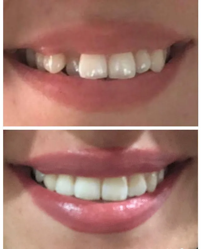 Smiledent diş kliniği Dişhekimi doğan tanrıverdi